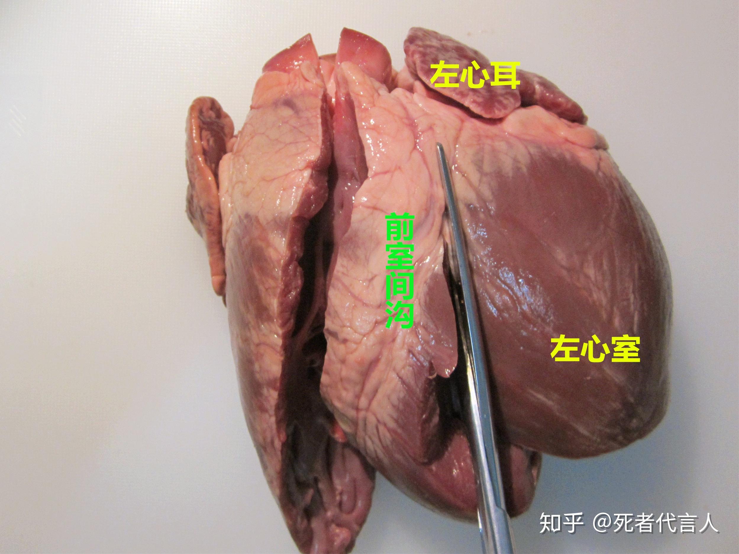 心臟的法醫學解剖