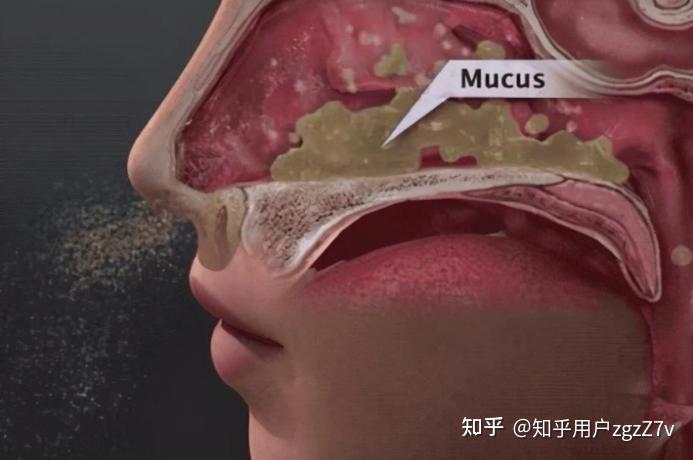 还是从樟脑,薄荷的性质上来看,都容易刺激到鼻腔黏膜,导致鼻腔黏膜