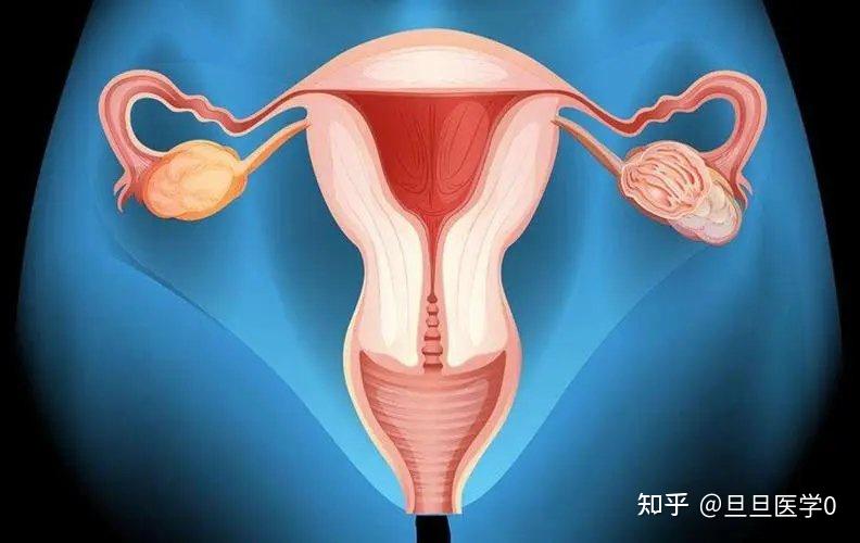 双角子宫能怀孕吗?