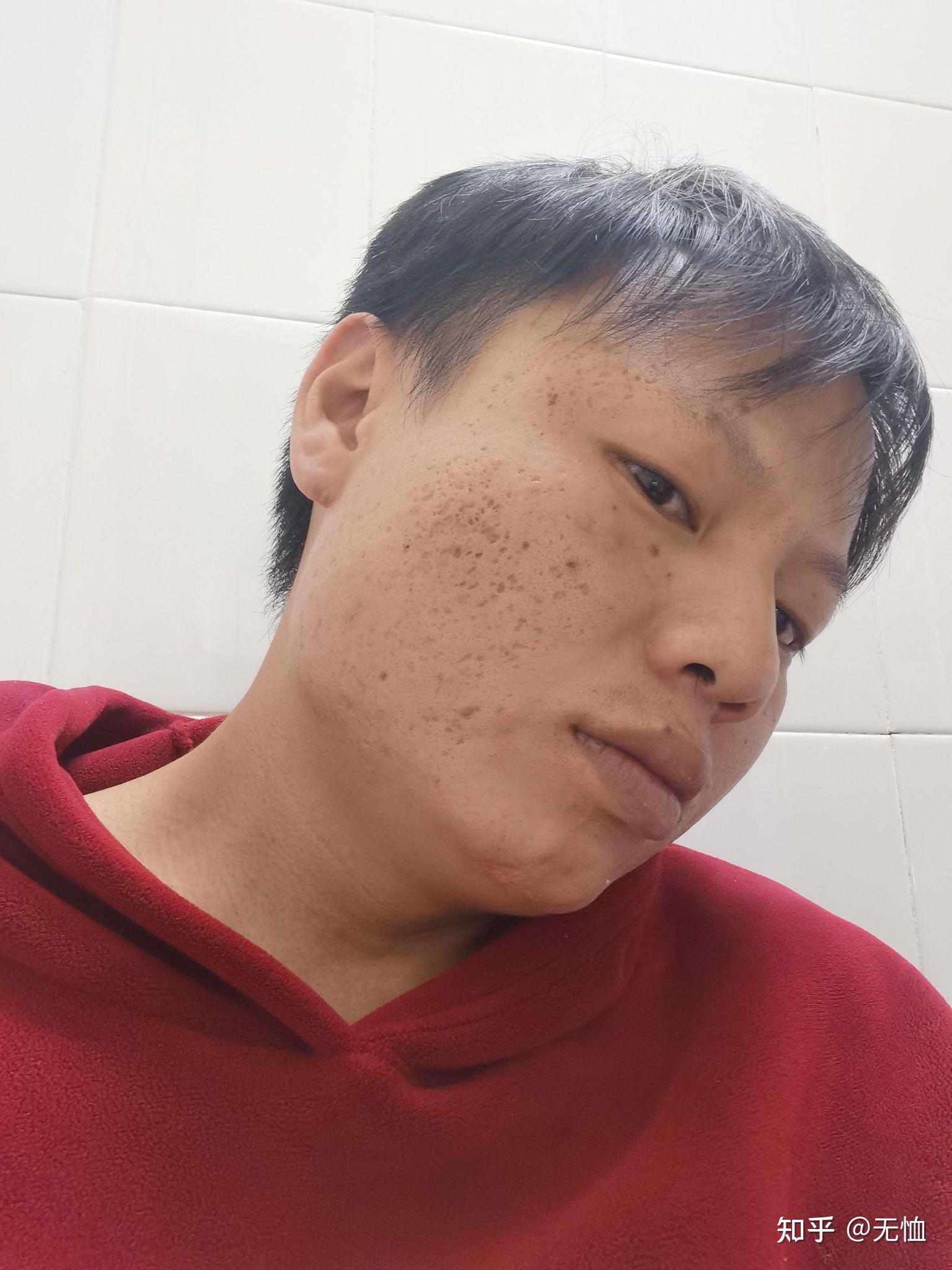 有没有长得丑的男生照片分享一下我想知道什么样算丑