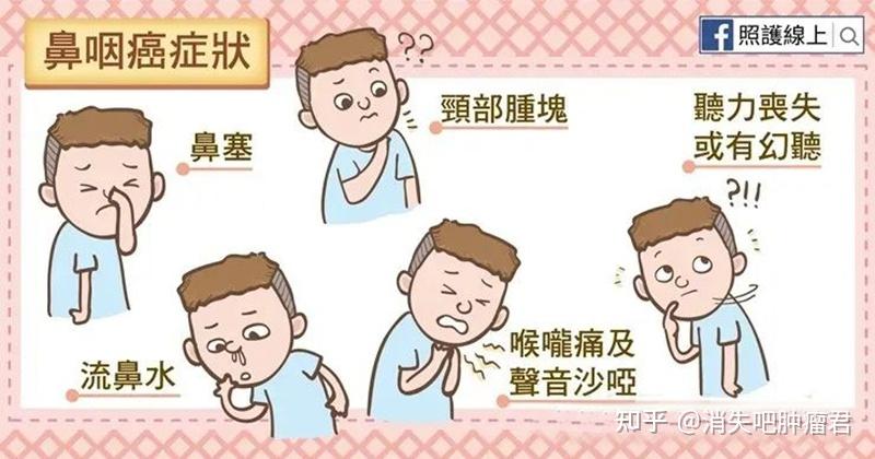 鼻咽癌患者放疗并发症的处理与指导 - 知乎