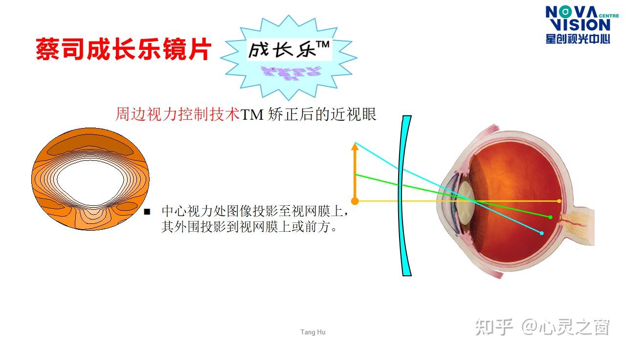 成长乐镜片原理图片