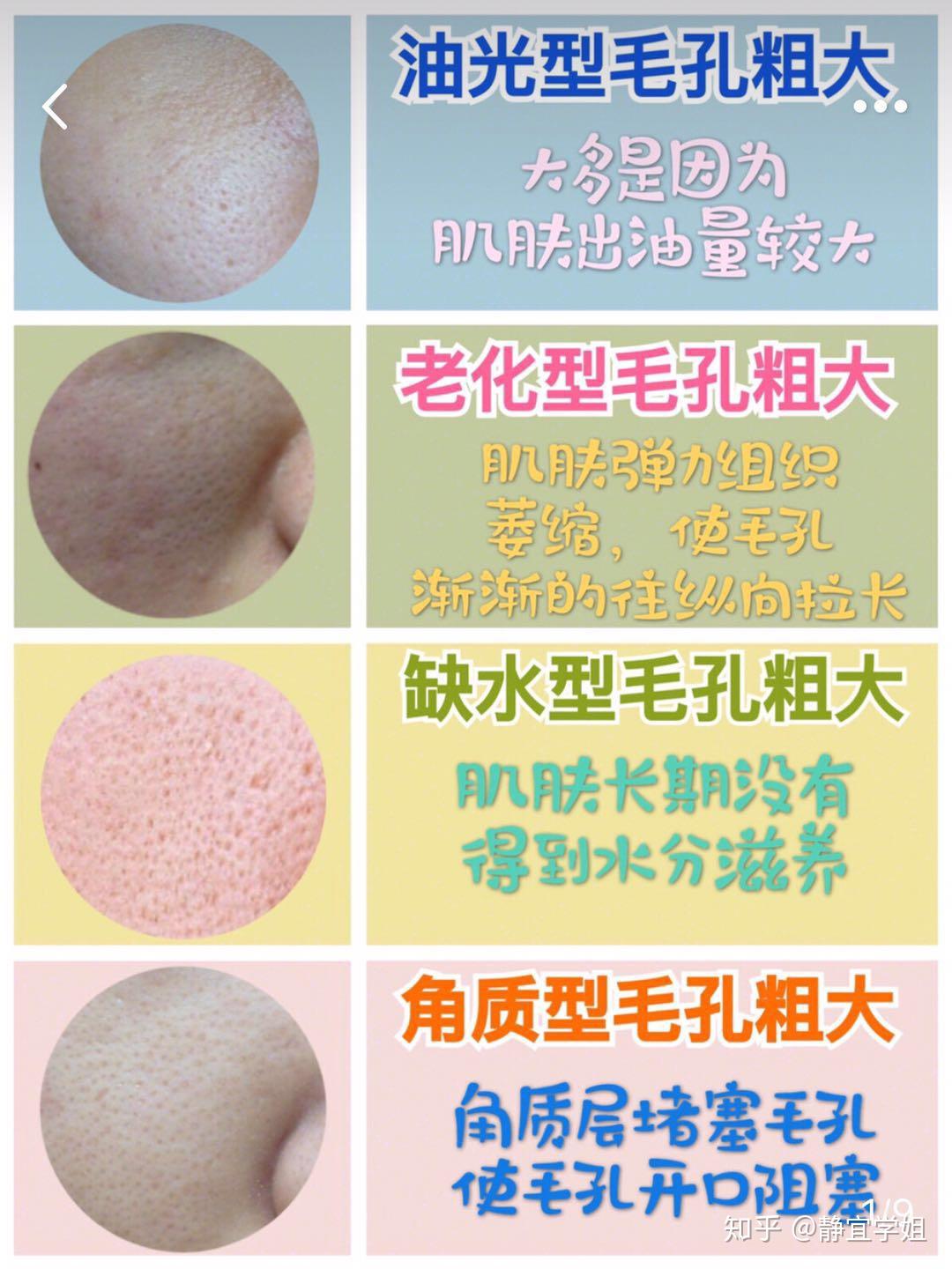 毛孔粗大之后真的不可逆吗? - 知乎
