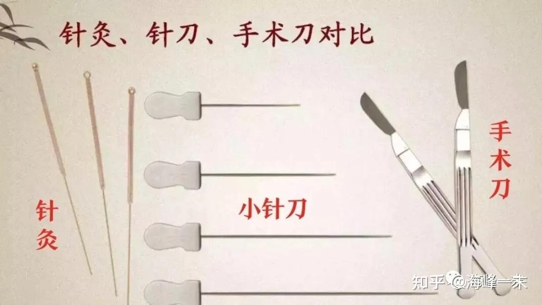 针灸火针针刀齐上阵我的颈椎病希望这次还有的救