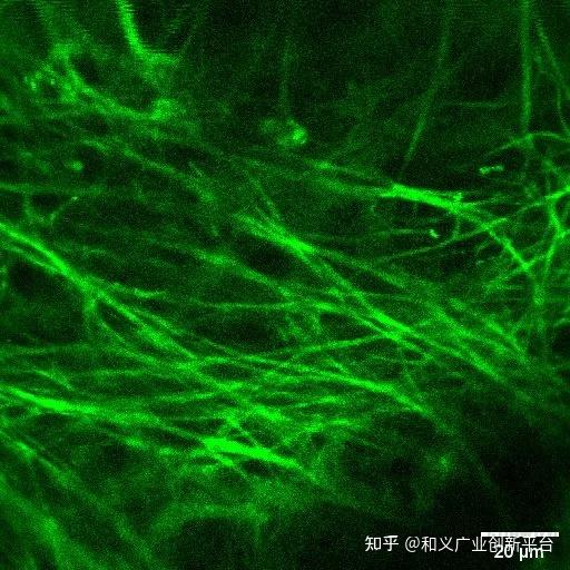3大应用场景!超维景“国产首款在体双光子显微成像系统”崭露行业头角 - 知乎