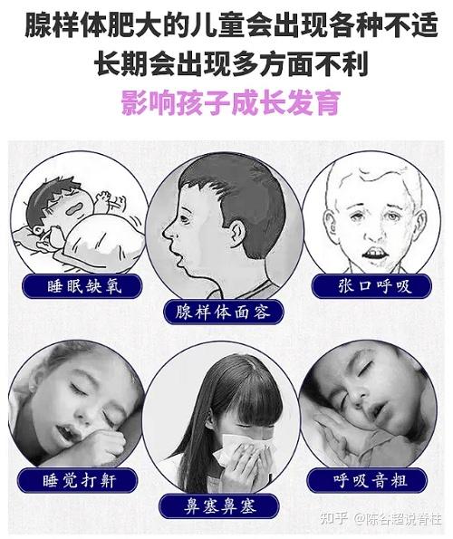 如果大家对于腺样体肥大症有一定的了解,就会知道该病多发于儿童,尤其