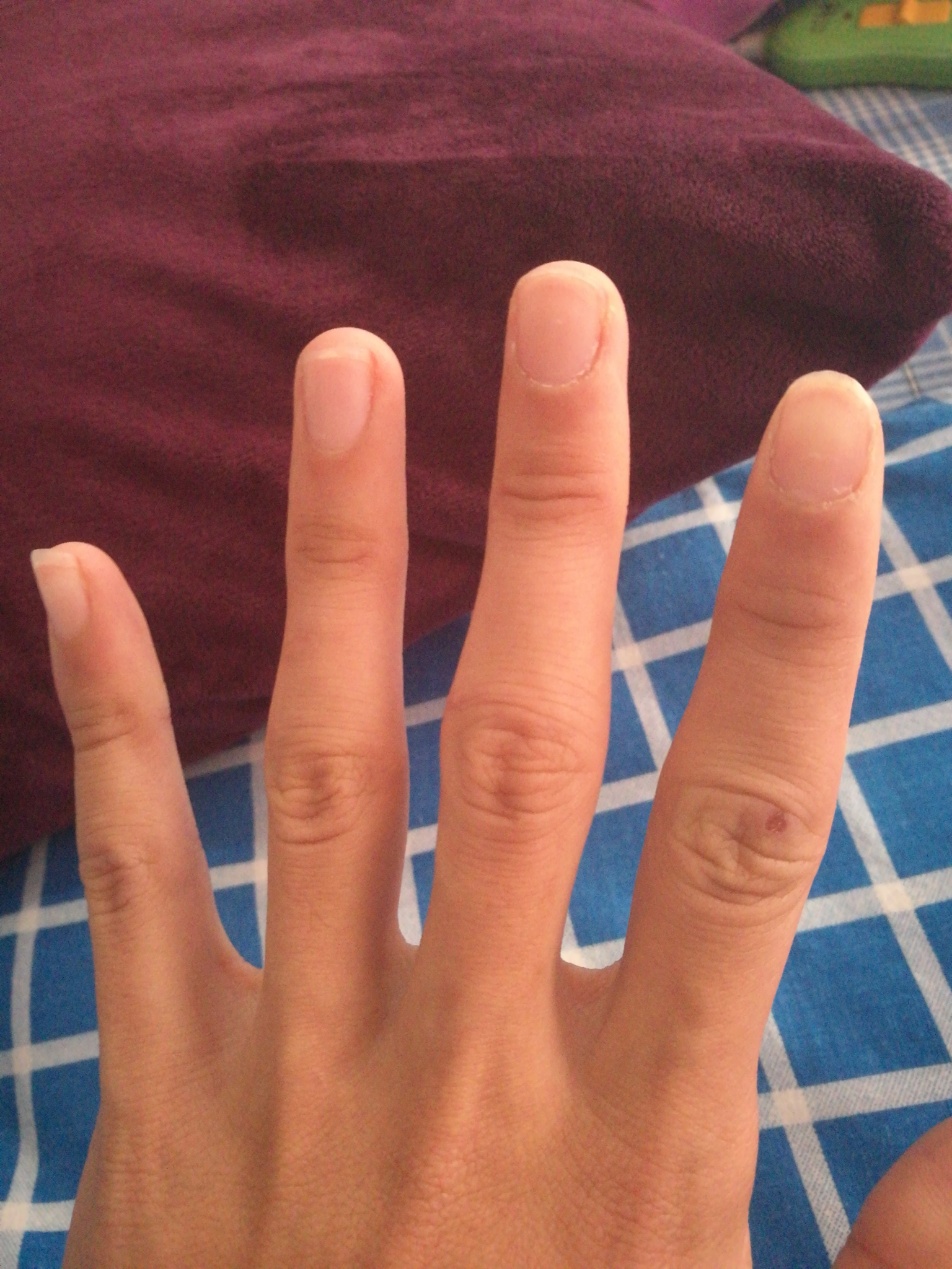 手指甲没有小月牙怎么办? ? - 知乎