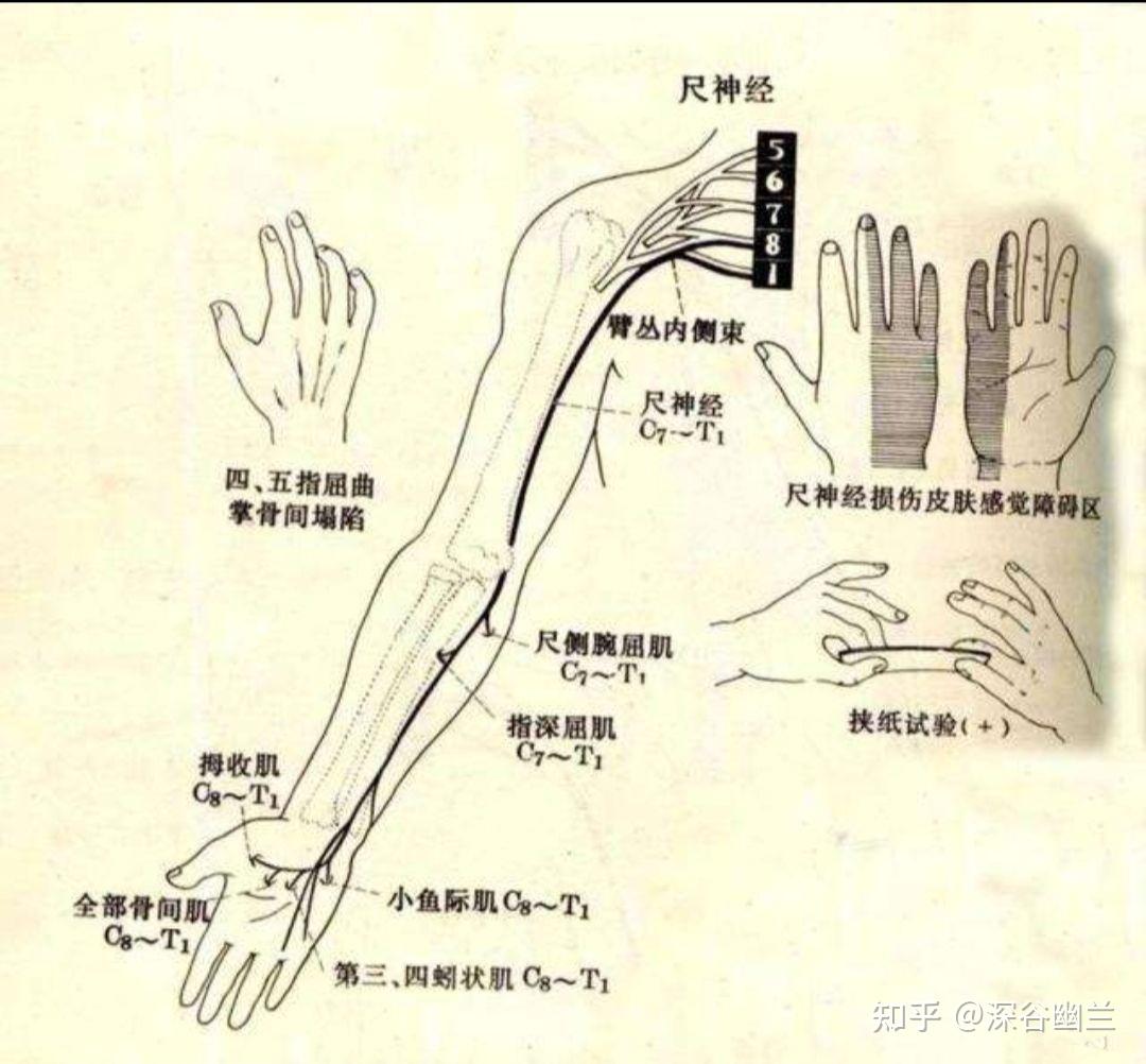 尺神经(c7～t1)尺神经是臂丛内侧束的直接延续正中神经(c6～t1)