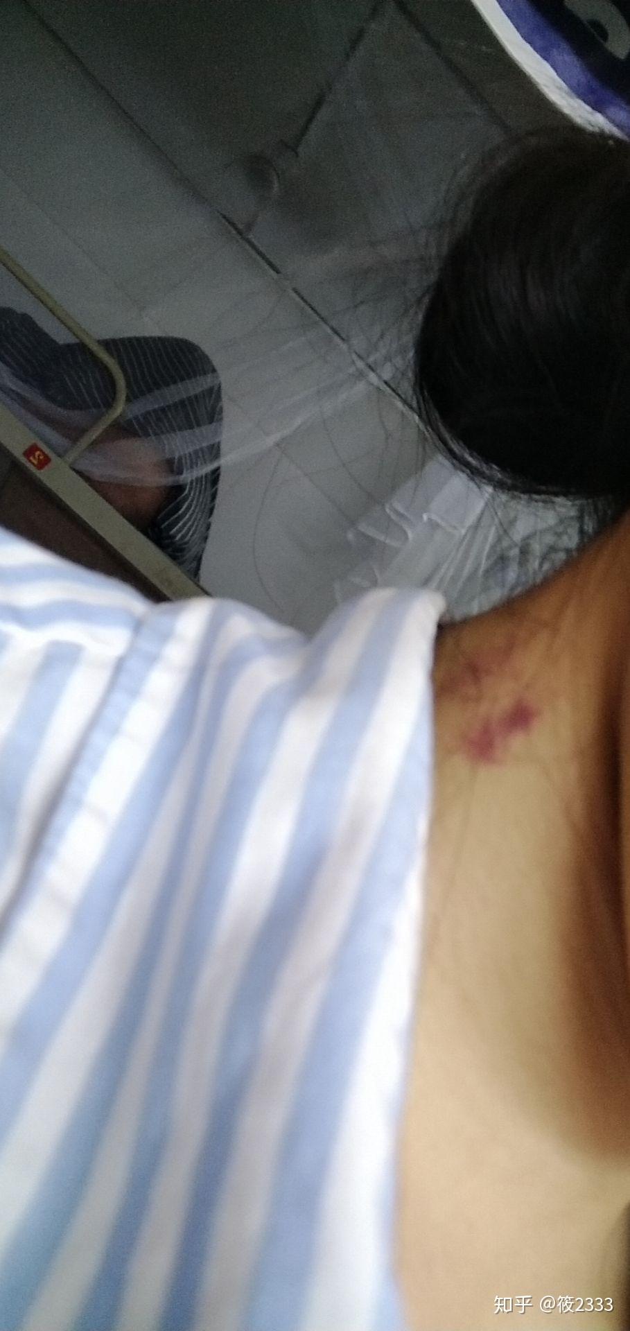 草莓(吻痕)种不出来是为什么? - 知乎