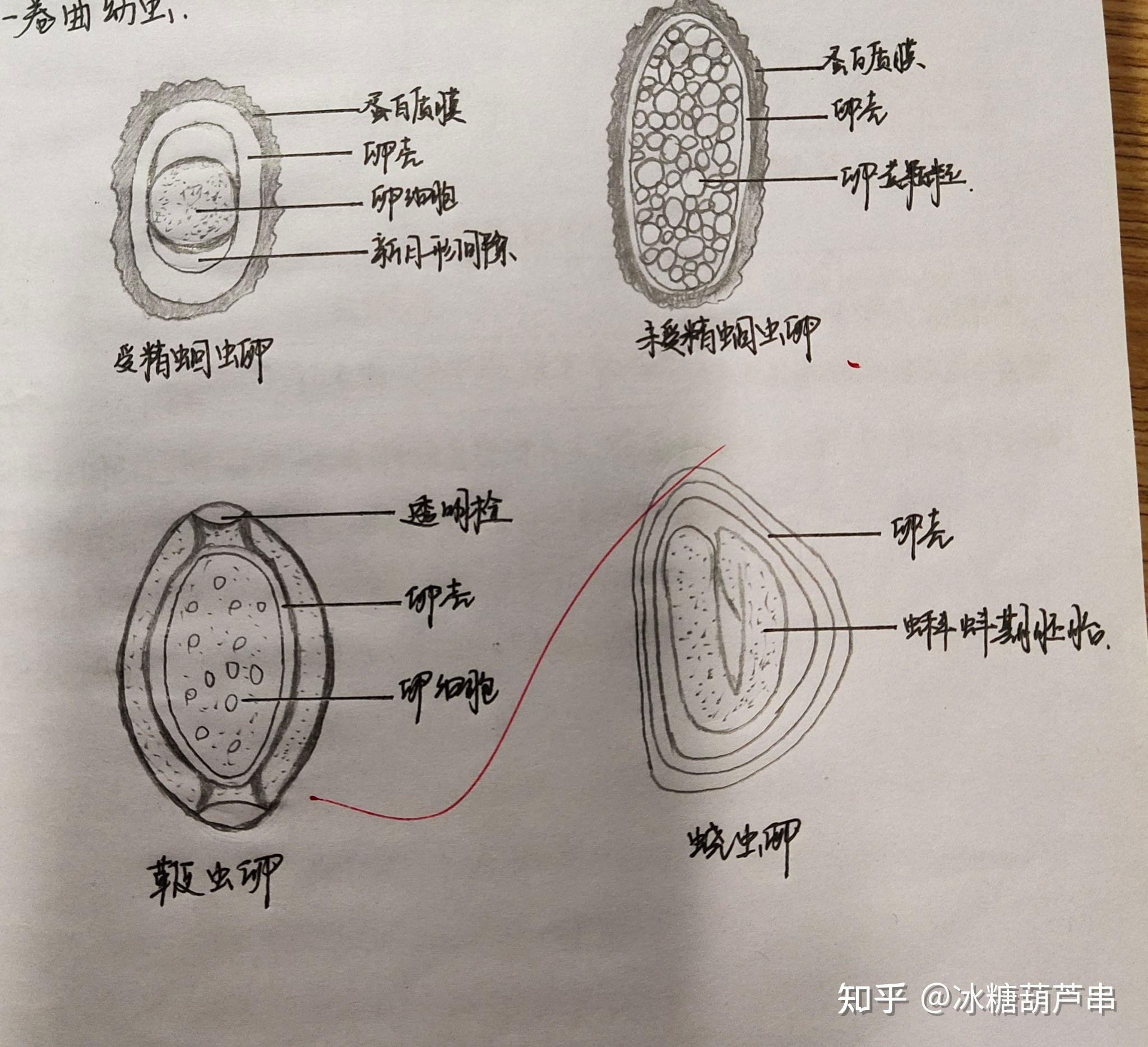 旋毛虫幼虫囊包铅笔图片