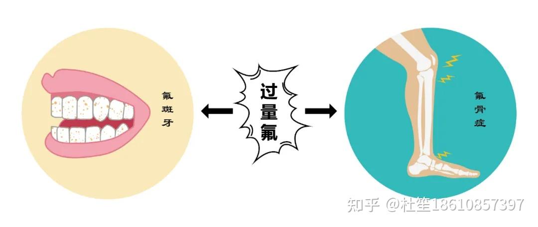 除氟可提高饮用水安全性预防氟中毒减少氟斑牙和氟骨症等疾病除氟成套