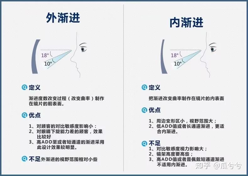 渐进片相关设计 - 知乎