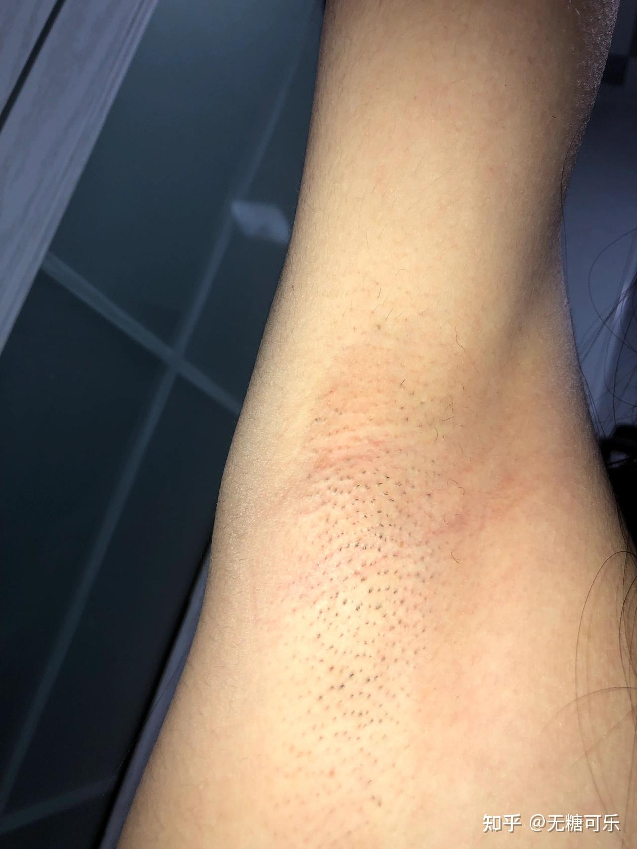 女生脱毛膏哪个牌子的比较好用? - 知乎