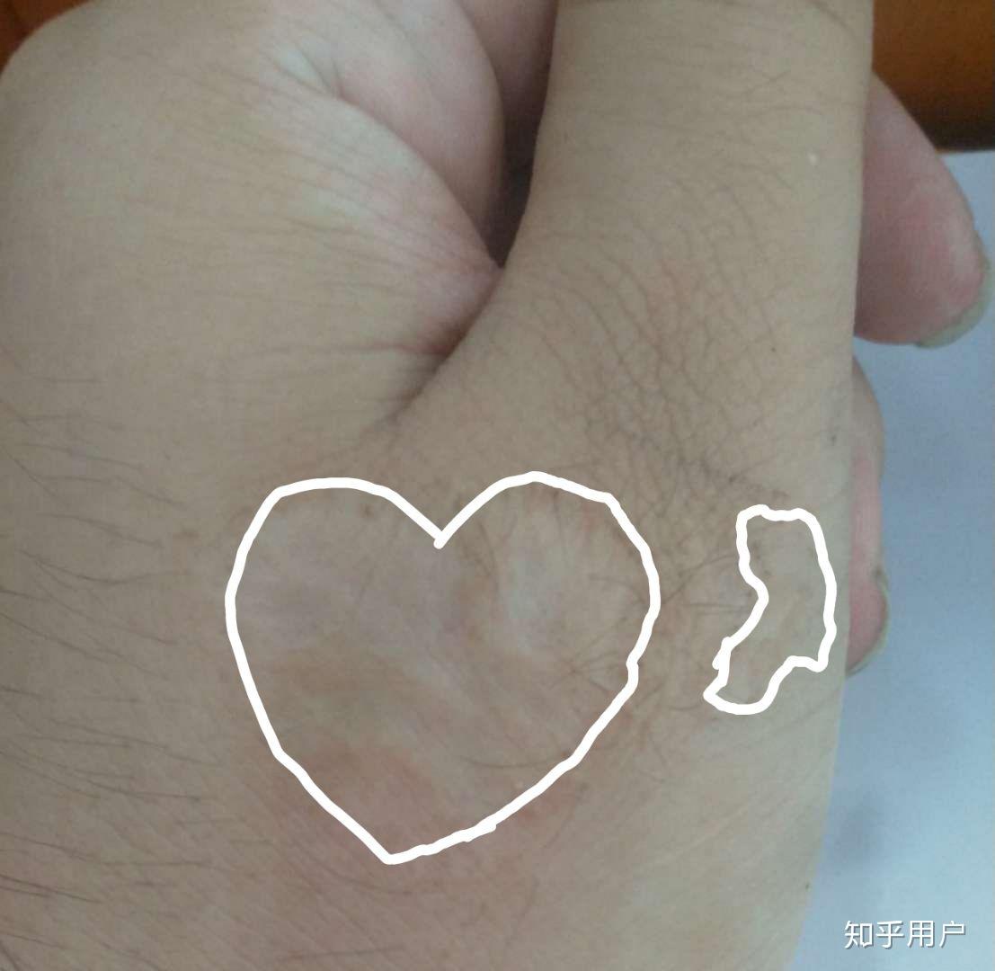 你身上有什么好看的伤疤?