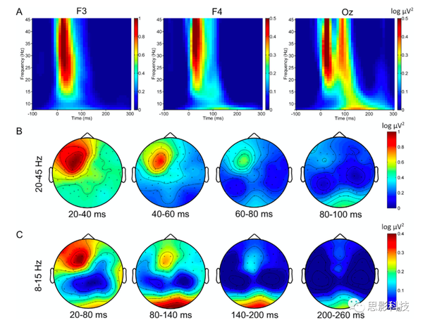 TMS-EEG的临床应用及展望- 知乎