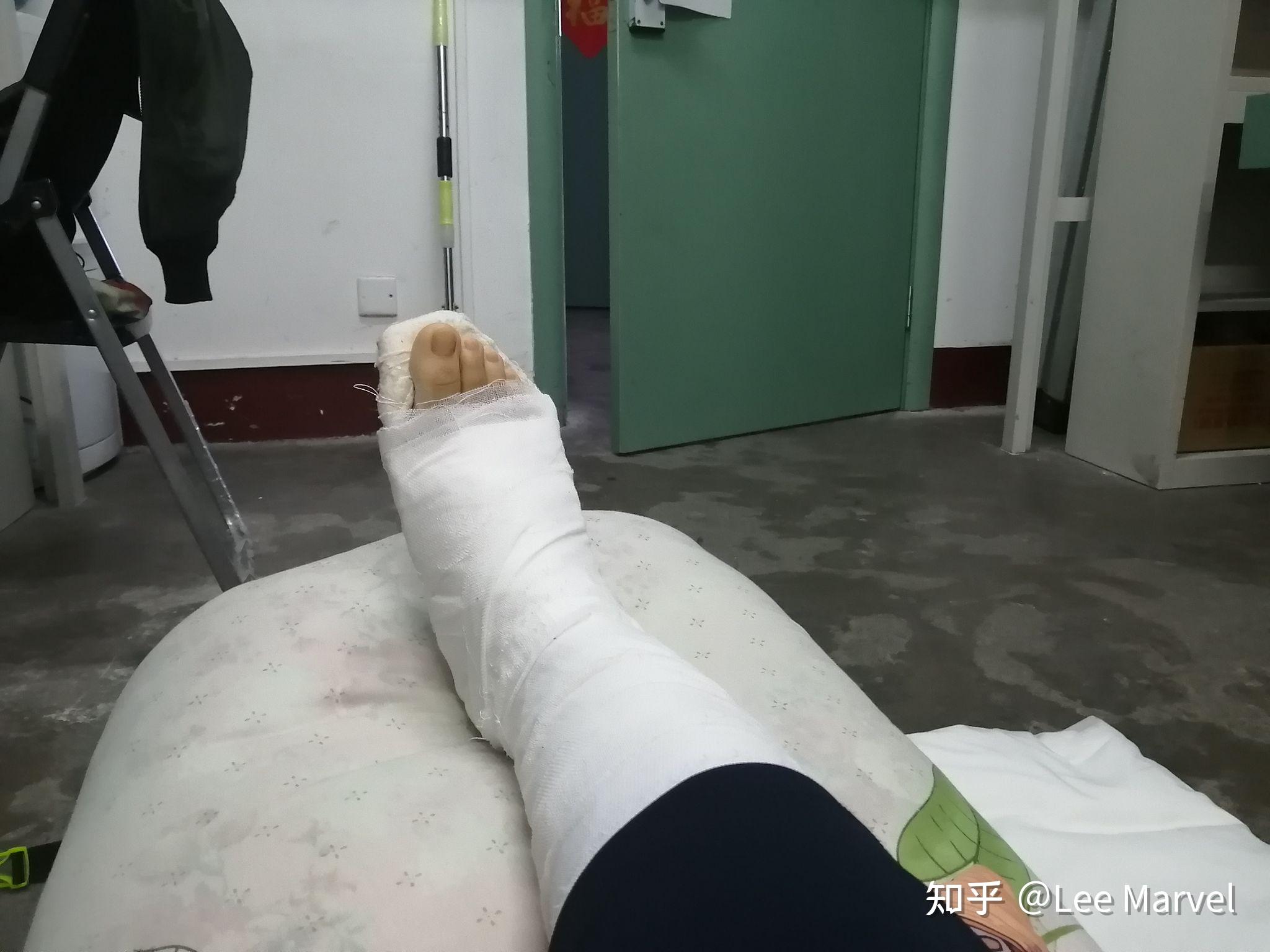 大学脚骨折无法走路怎么在宿舍赶上学习进度和调整身心状态