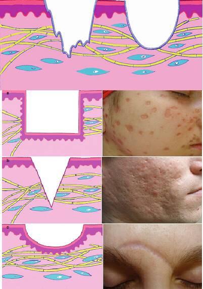 拯救月球脸原来靠这些技术