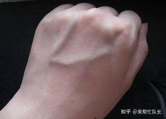 青筋突出 zhuanlan.zhihu.com