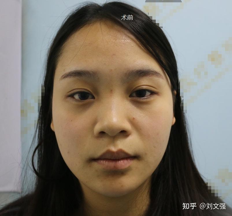 有在武汉整容过的朋友吗 可以推荐一下吗? - 知乎