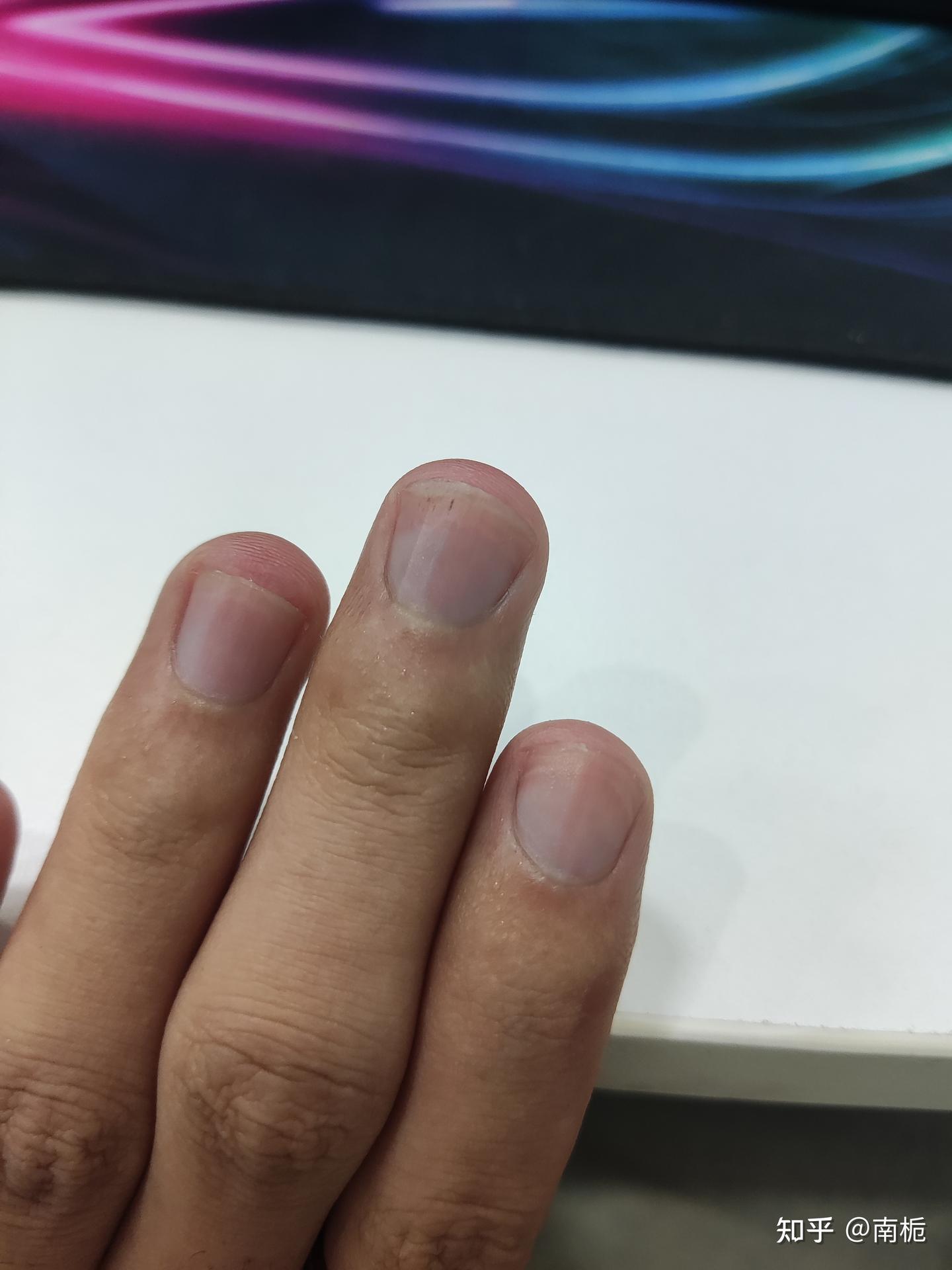 记录一下养指甲游离线 - 知乎