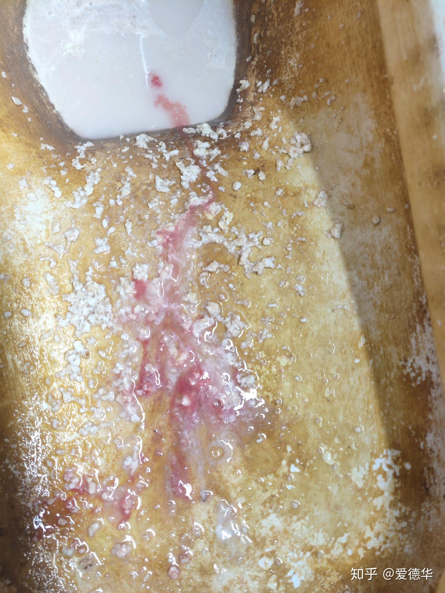 你喝酒喝到吐血的那次是那次你还记得吗