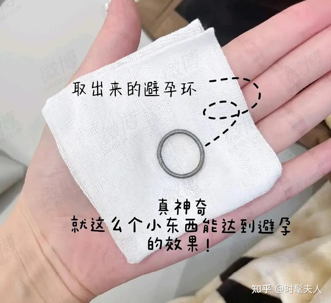 "末了,她还对着取出来的避孕环感叹她甜蜜给镜头比耶男友陪她取环