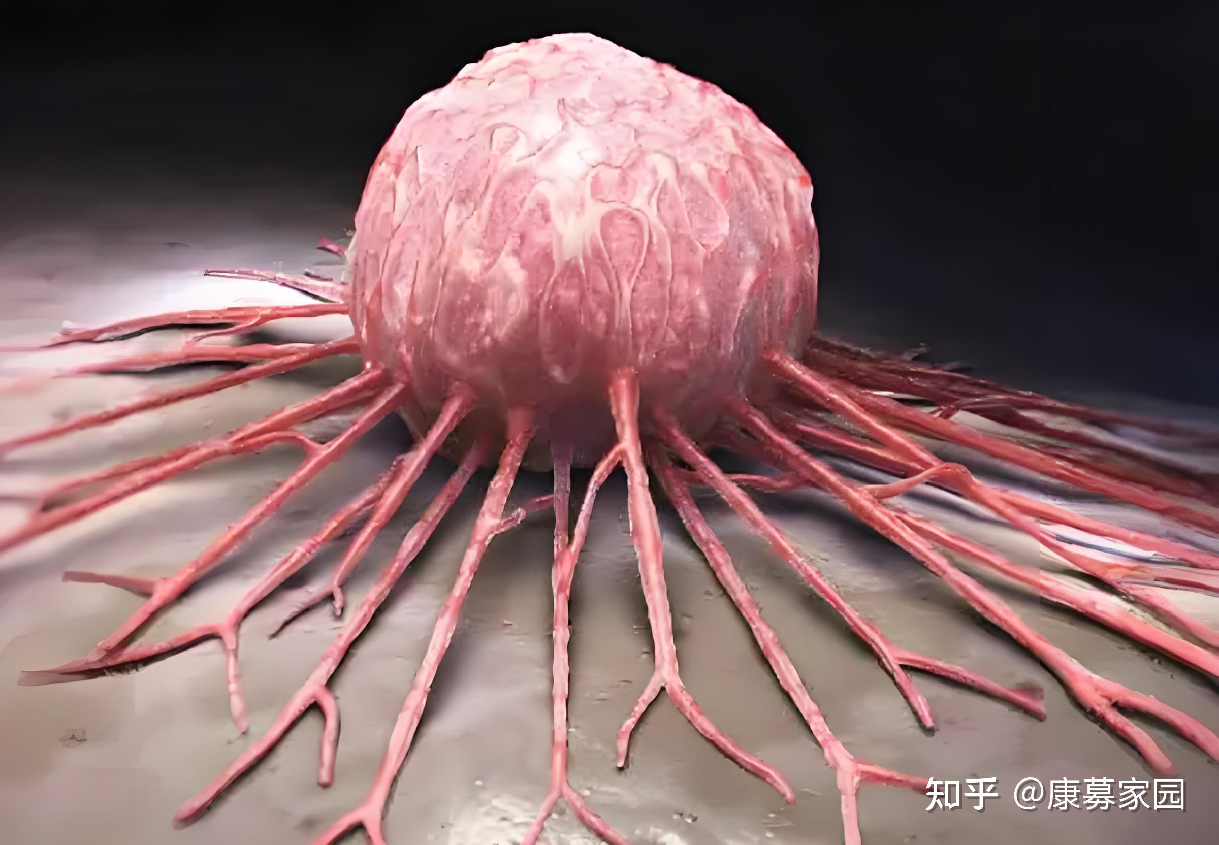 患癌晚期的老人还继续治疗吗