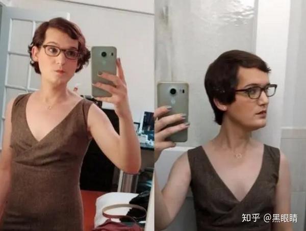 雌激素不仅让他越来越女性化,也让她的头发有了第二春.
