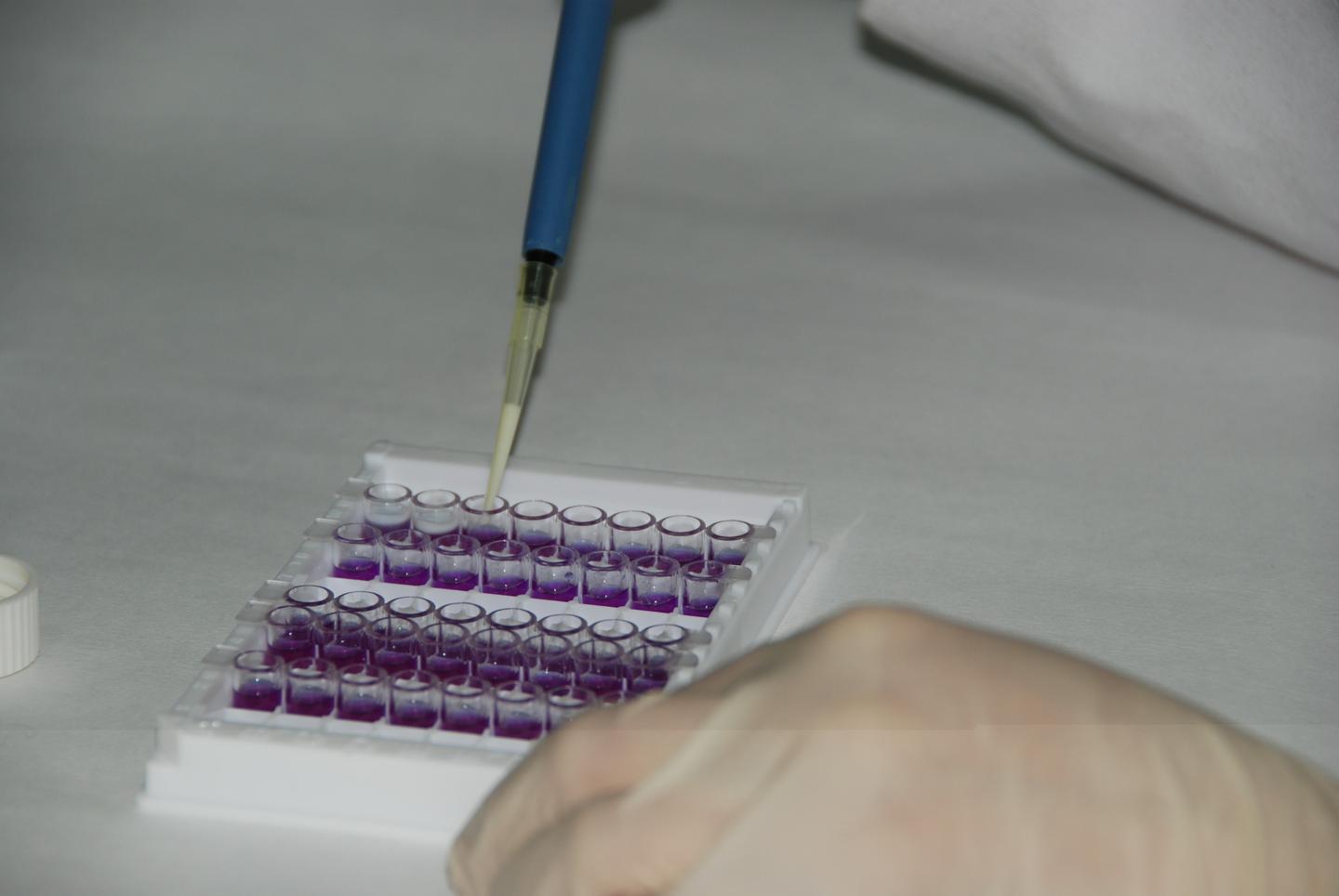 做实验 | elisa实验显性淡,灵敏度低是为什么?怎么解决?