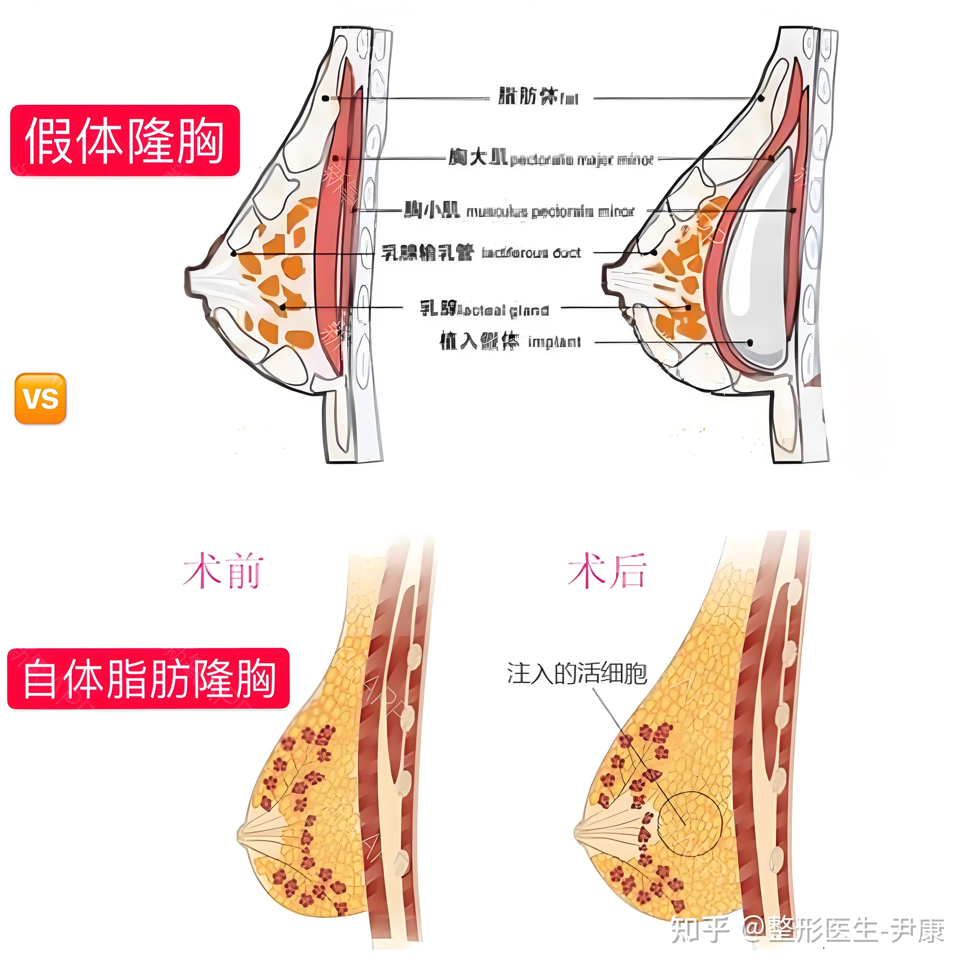 为什么胸那么大丰胸图片