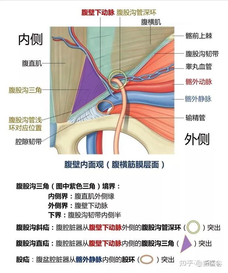 腹股沟管的构成图片