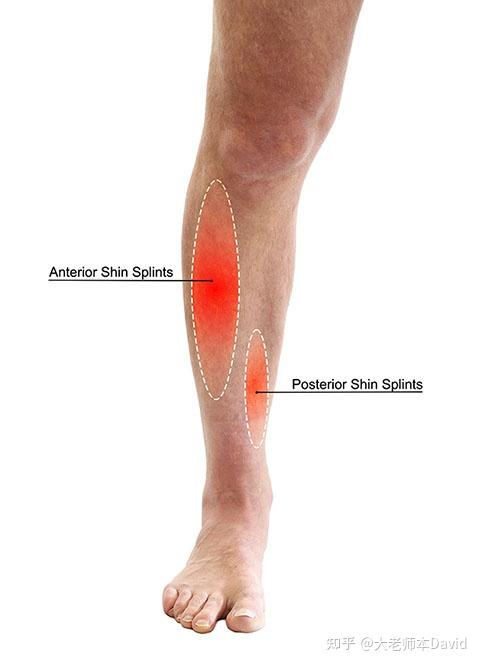 小腿前面疼图片