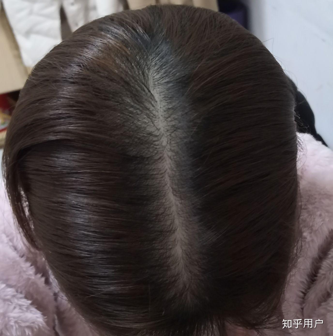 女生头发少是一种怎样的体验