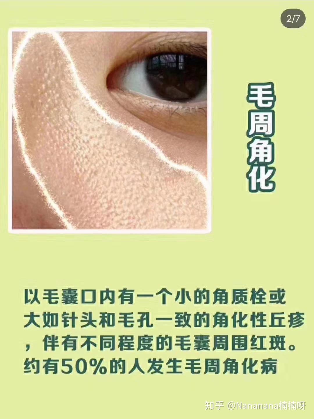 v2-44cd8c91394ae4d3899792ecedfa177c_r.jpg