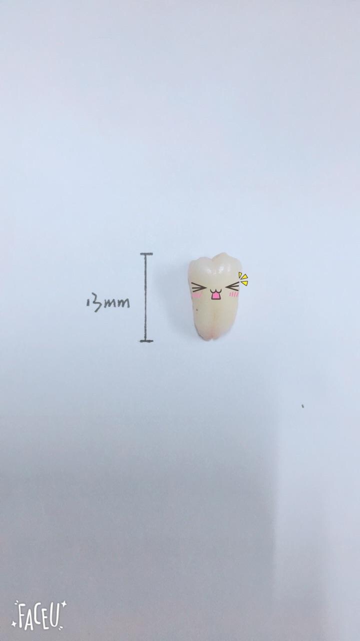 拔智齿有多痛? - 知乎