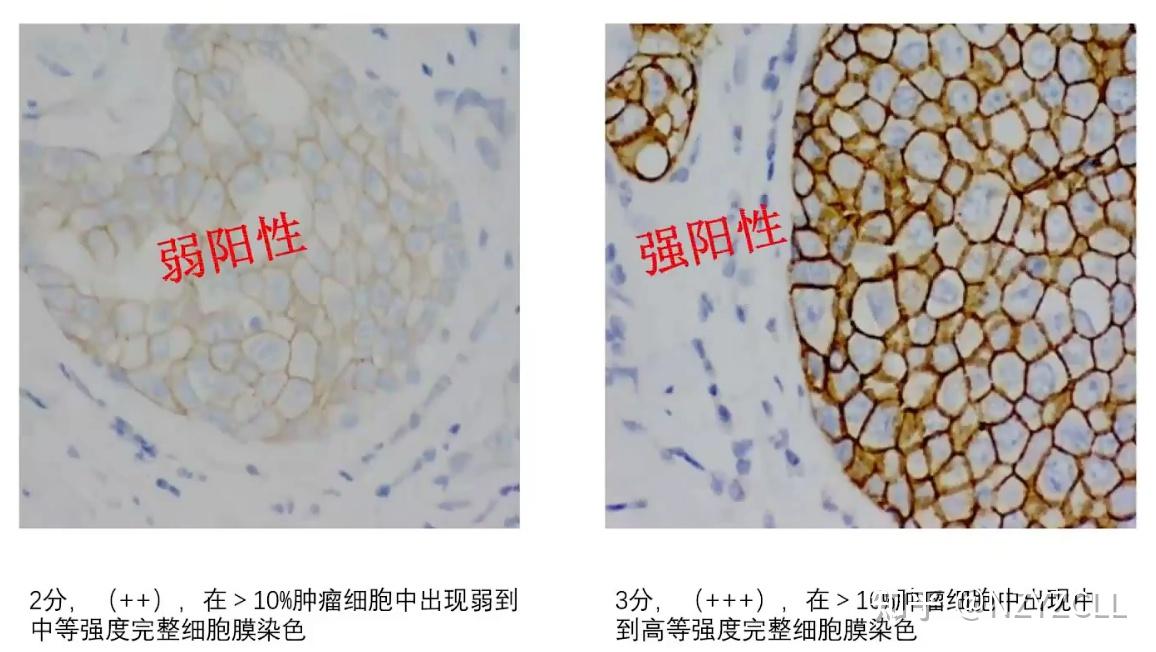免疫组织化学实验IHC - 知乎