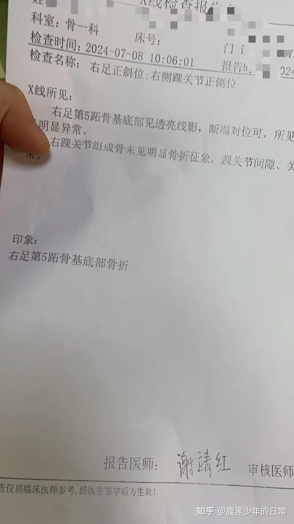 第一跖骨基底部图片