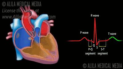 心脏泵血图核磁共振下,脑脊液随心跳搏动三维动态血管成像动态ct下的