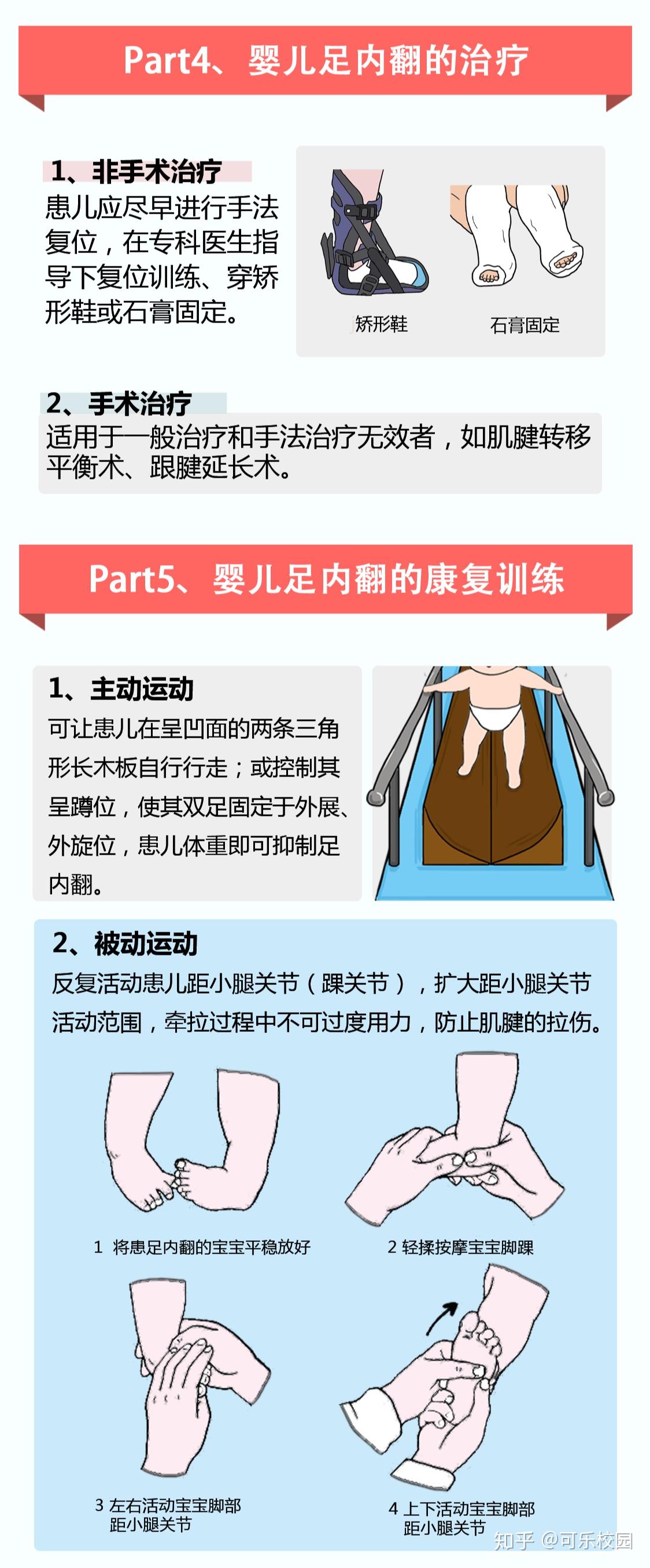 内翻足是怎么回事有什么症状如何治疗