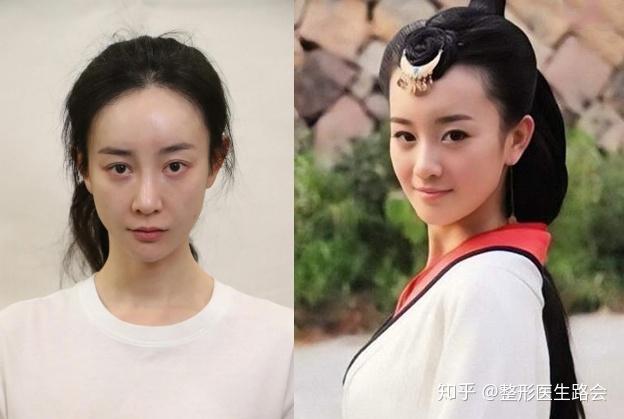 张檬哭诉后悔整容!从"氧气少女"到"塑料网红",她都做了啥?