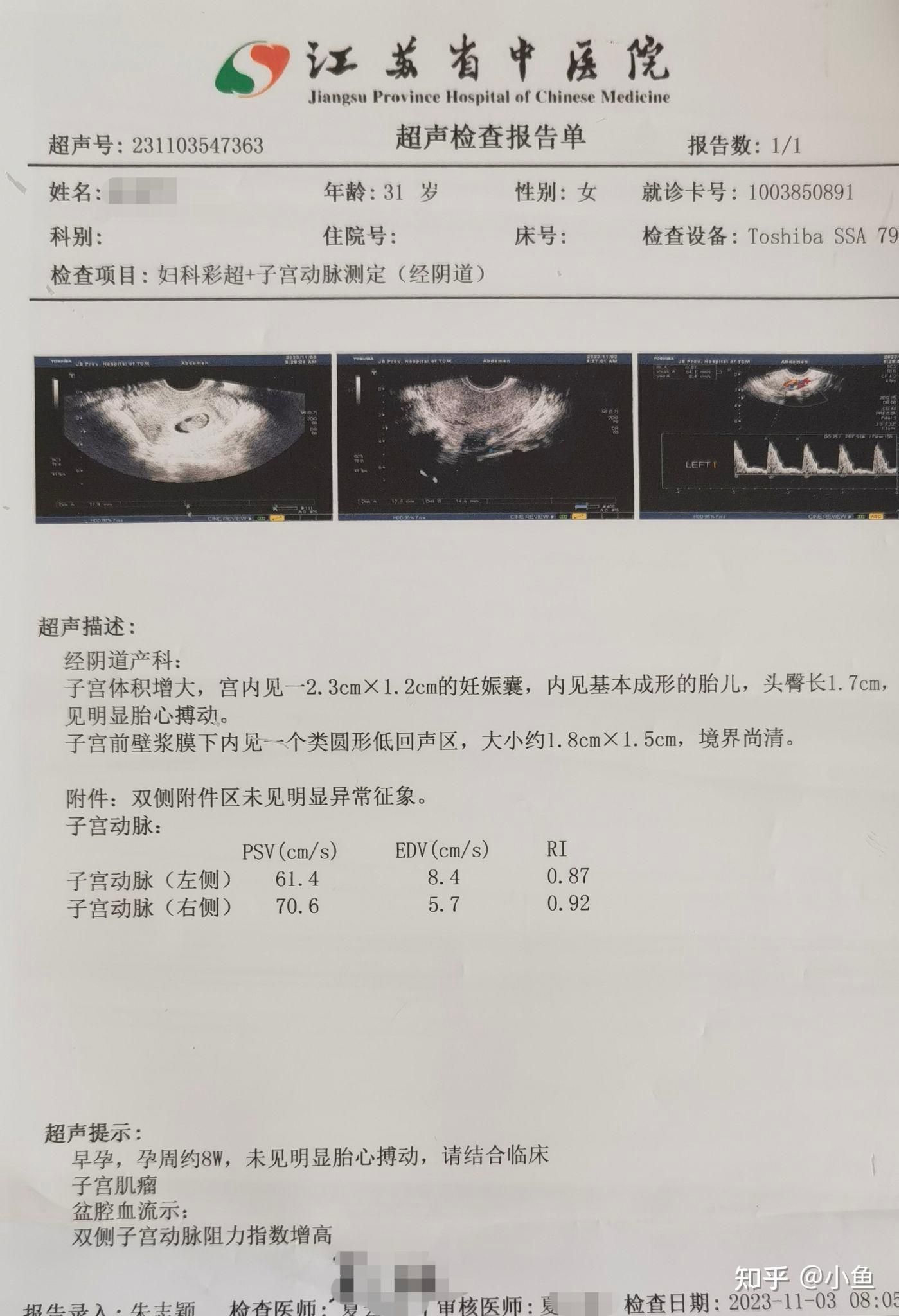 药流诊断图片