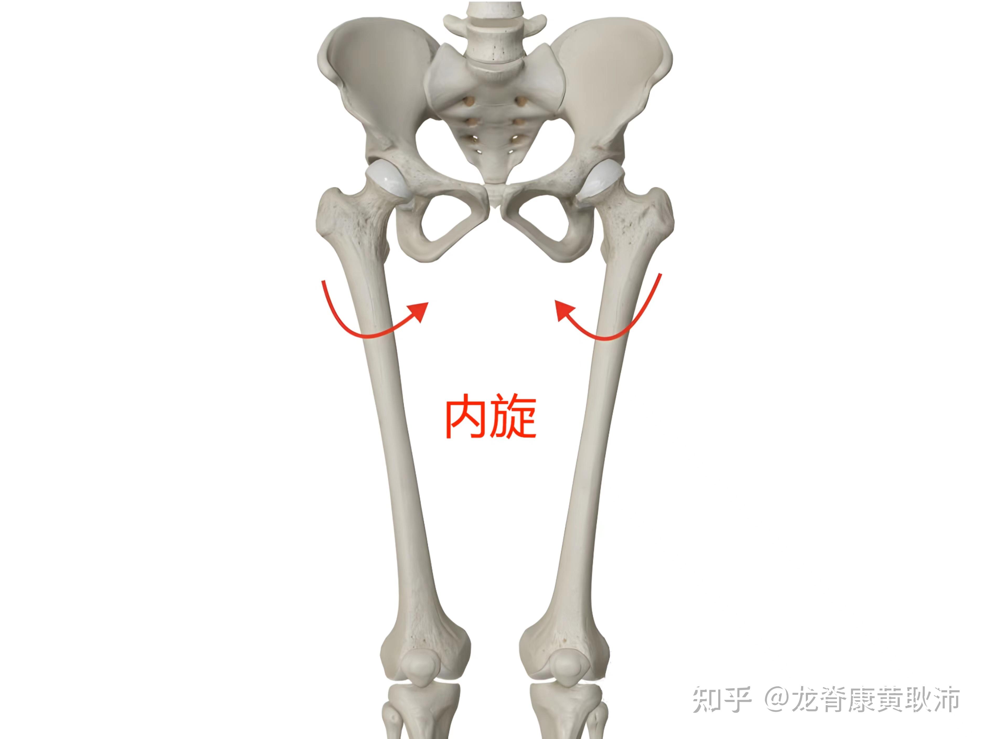 xo型腿x光片图片