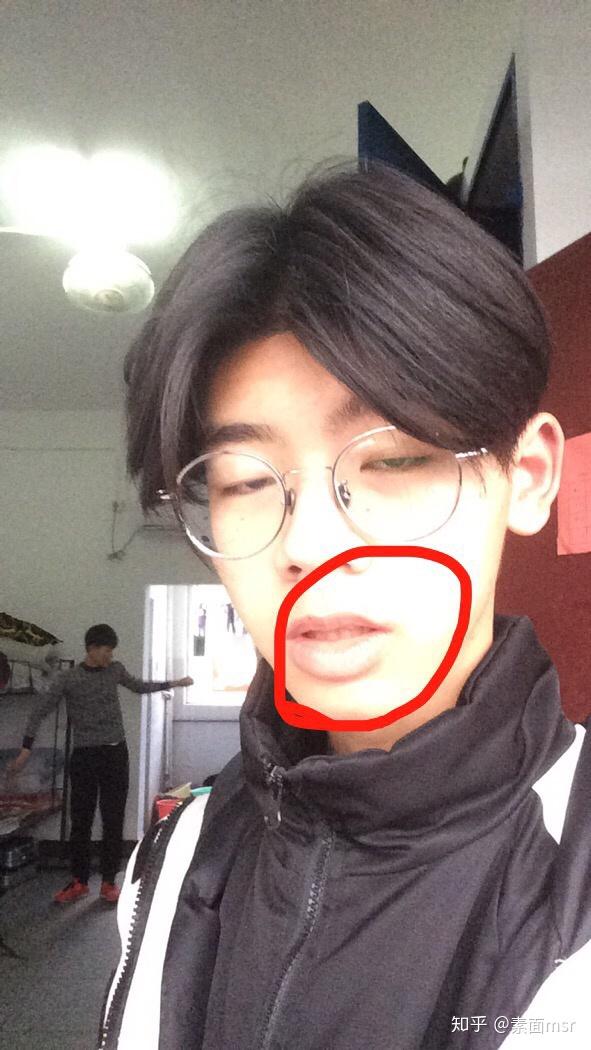 嘴唇厚的男生真的很丑吗