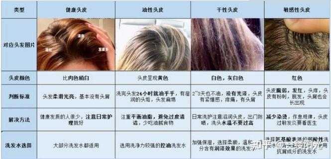 洗发水推荐洗发水怎么选不同发质应该选择洗发水值得回购的男士女士