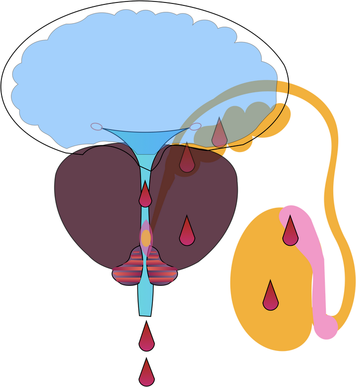 血精,要不要紧?
