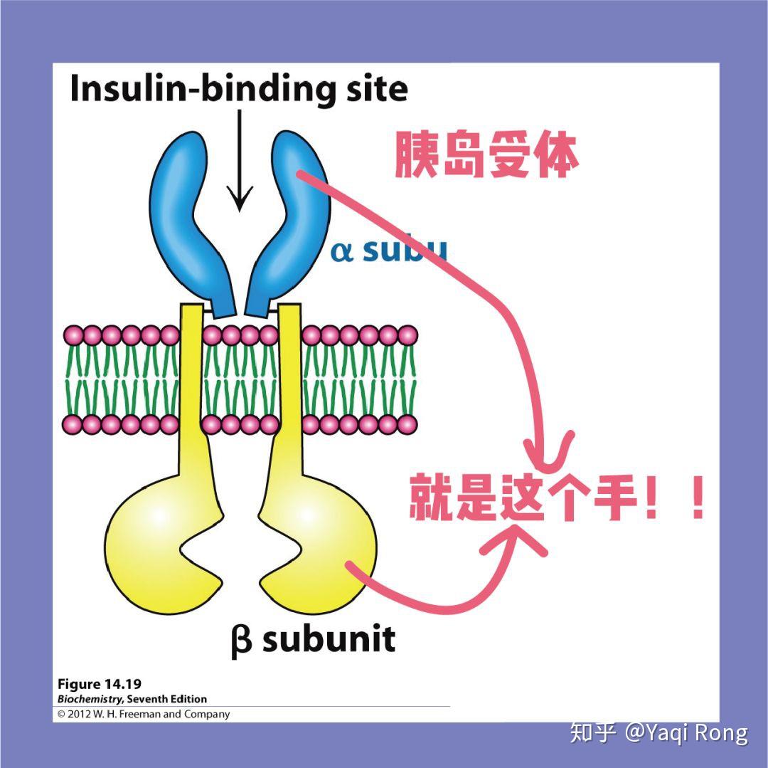 不是缺胰岛素,而是产生了胰岛抵抗