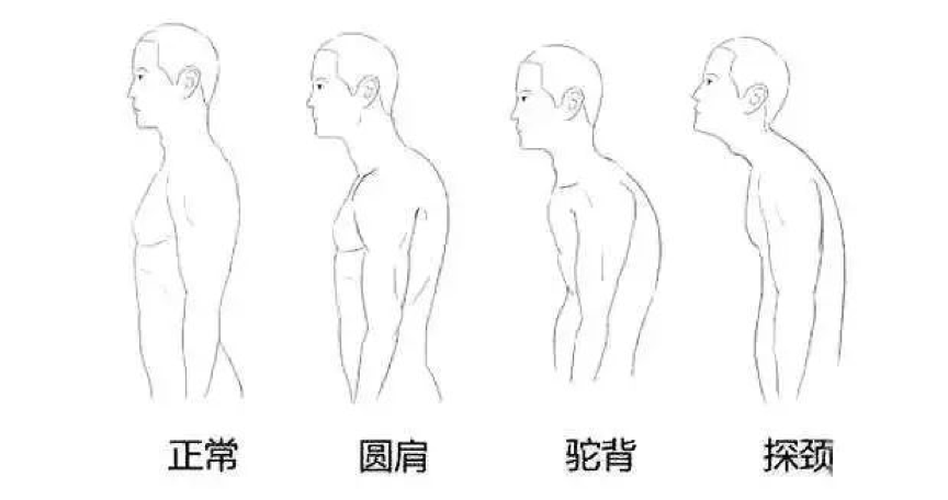 lp特邀教练木库罗表示