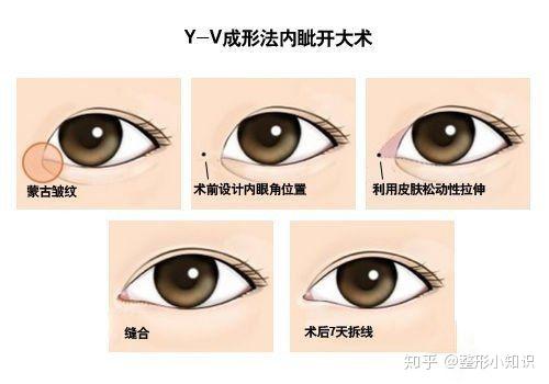 v2-46411caa3a76470395d0565931345cb4_r.jpg