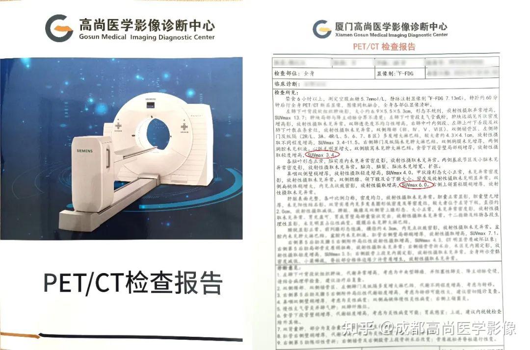 【高尚科普】了解PET/CT报告中的SUV值 - 知乎