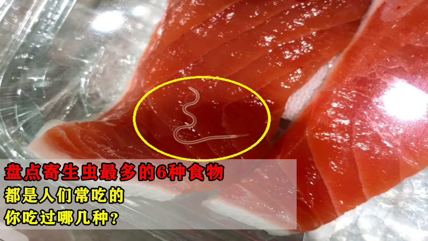 如果吃了有寄生虫的食物怎么办? - 知乎